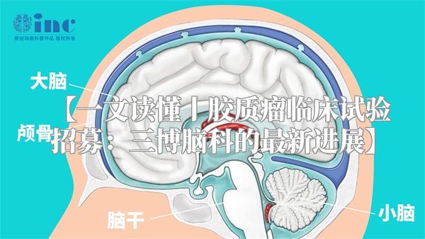 【一文读懂丨胶质瘤临床试验招募：三博脑科的最新进展】