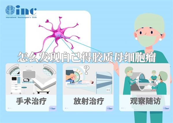怎么发现自己得胶质母细胞瘤？