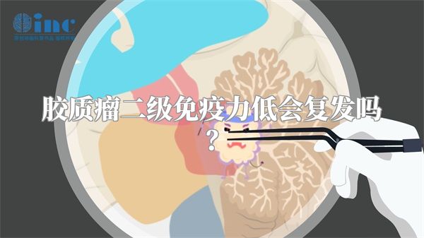 胶质瘤二级免疫力低会复发吗？