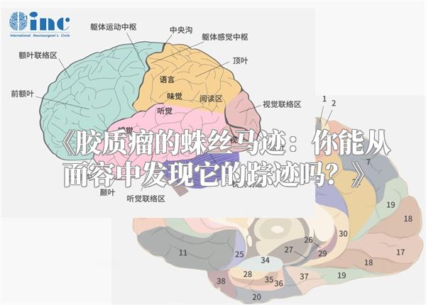 《胶质瘤的蛛丝马迹：你能从面容中发现它的踪迹吗？》