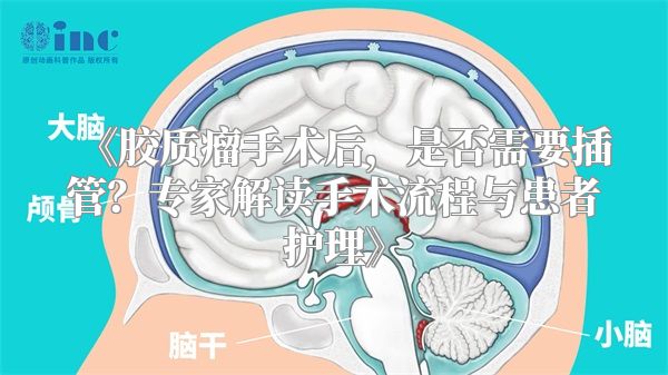 《胶质瘤手术后，是否需要插管？专家解读手术流程与患者护理》