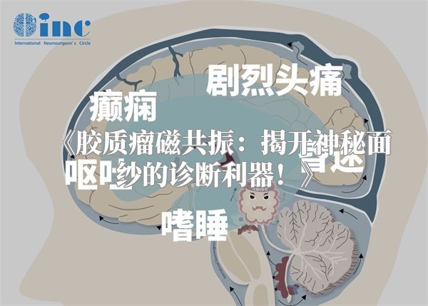 《胶质瘤磁共振：揭开神秘面纱的诊断利器！》