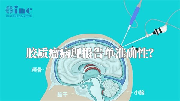 胶质瘤病理报告单准确性？