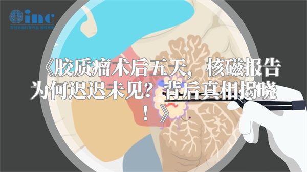 《胶质瘤术后五天，核磁报告为何迟迟未见？背后真相揭晓！》
