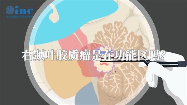 右颞叶胶质瘤是在功能区吗？