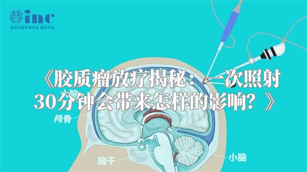 《胶质瘤放疗揭秘：一次照射30分钟会带来怎样的影响？》