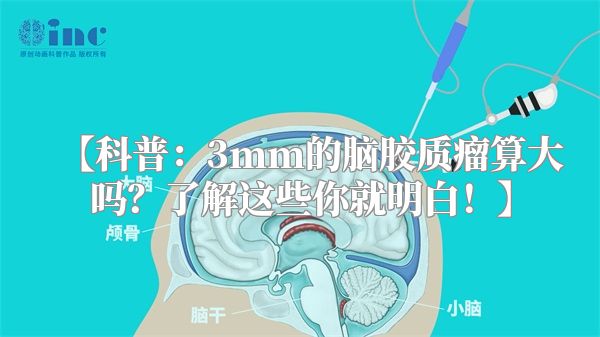 【科普：3mm的脑胶质瘤算大吗？了解这些你就明白！】