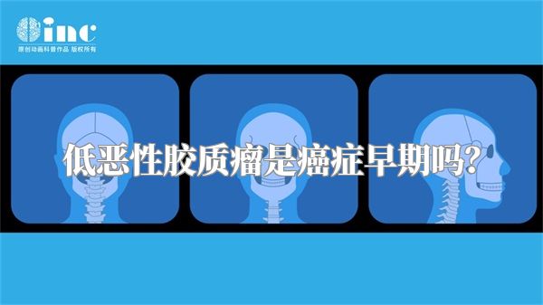 低恶性胶质瘤是癌症早期吗？
