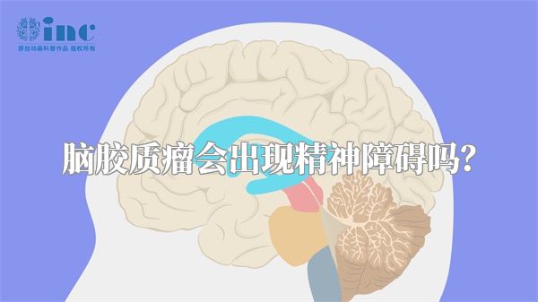 脑胶质瘤会出现精神障碍吗？