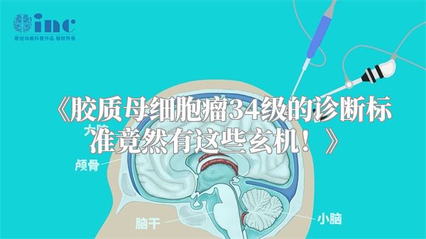 《胶质母细胞瘤34级的诊断标准竟然有这些玄机！》
