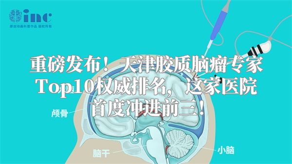 重磅发布！天津胶质脑瘤专家Top10权威排名，这家医院首度冲进前三！