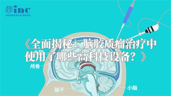 《全面揭秘：脑胶质瘤治疗中使用了哪些高科技设备？》