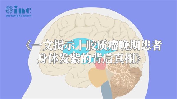 《一文揭示丨胶质瘤晚期患者身体发紫的背后真相》