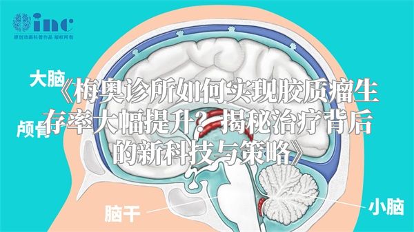 《梅奥诊所如何实现胶质瘤生存率大幅提升？揭秘治疗背后的新科技与策略》