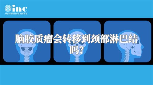 脑胶质瘤会转移到颈部淋巴结吗？