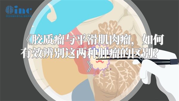 《胶质瘤与平滑肌肉瘤，如何有效辨别这两种肿瘤的区别？》