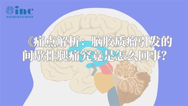《痛点解析：脑胶质瘤引发的间歇性腿痛究竟是怎么回事？》