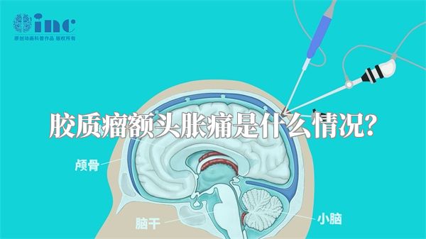 胶质瘤额头胀痛是什么情况？
