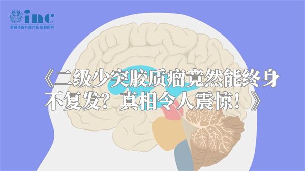 《二级少突胶质瘤竟然能终身不复发？真相令人震惊！》