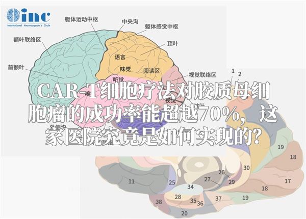 CAR-T细胞疗法对胶质母细胞瘤的成功率能超越70%，这家医院究竟是如何实现的？