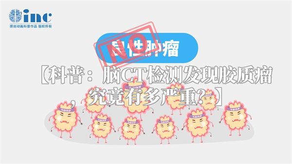 【科普：脑CT检测发现胶质瘤，究竟有多严重？】