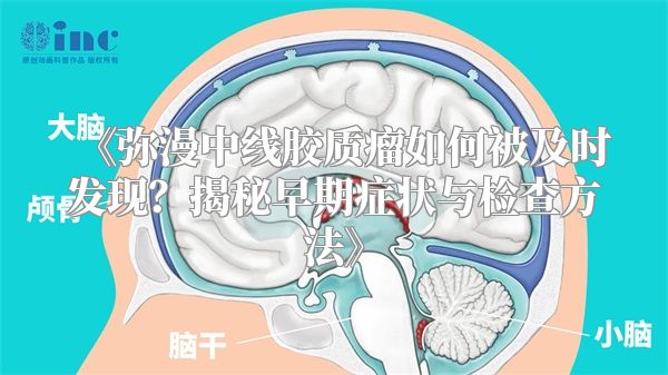 《弥漫中线胶质瘤如何被及时发现？揭秘早期症状与检查方法》