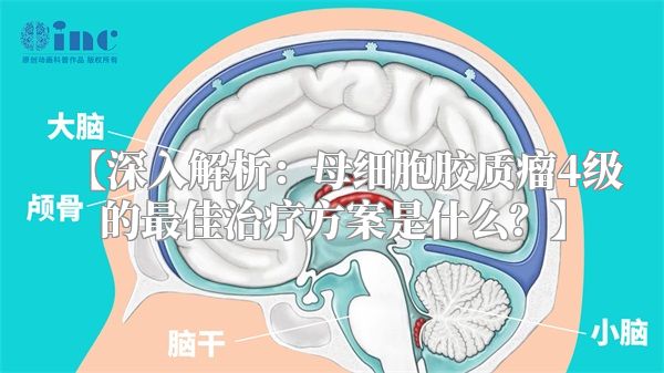 【深入解析：母细胞胶质瘤4级的最佳治疗方案是什么？】