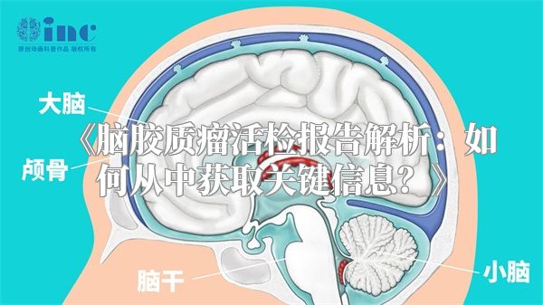 《脑胶质瘤活检报告解析：如何从中获取关键信息？》