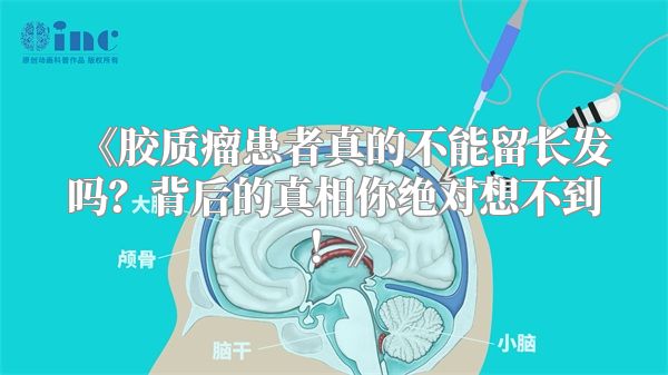 《胶质瘤患者真的不能留长发吗？背后的真相你绝对想不到！》