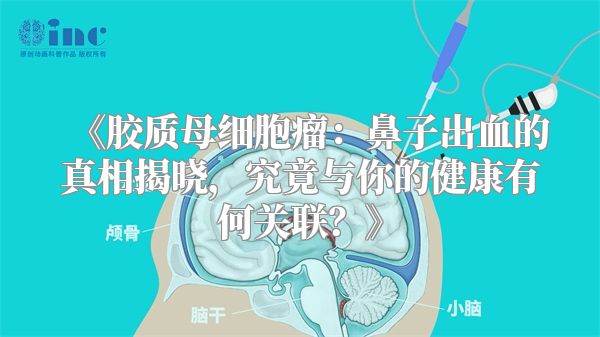 《胶质母细胞瘤：鼻子出血的真相揭晓，究竟与你的健康有何关联？》