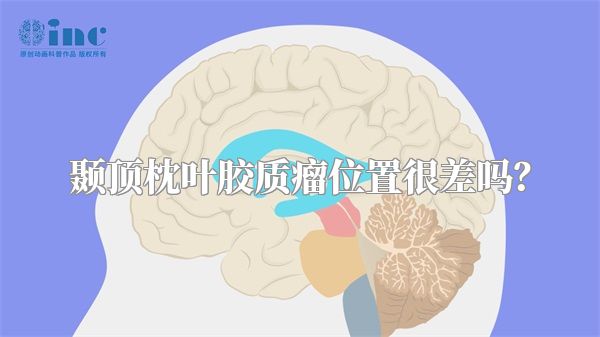颞顶枕叶胶质瘤位置很差吗？