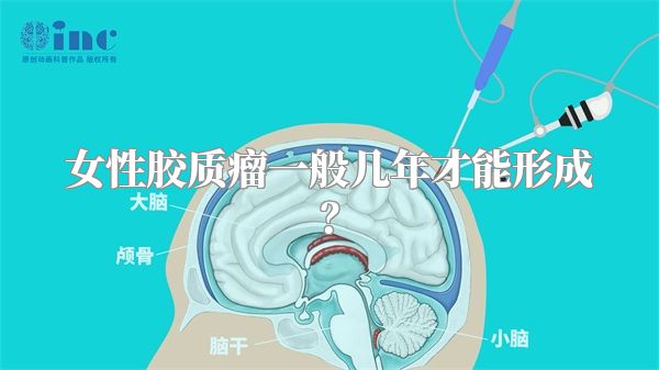 女性胶质瘤一般几年才能形成？