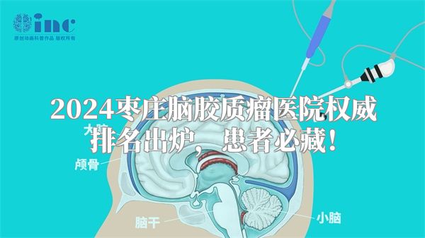 2024枣庄脑胶质瘤医院权威排名出炉，患者必藏！