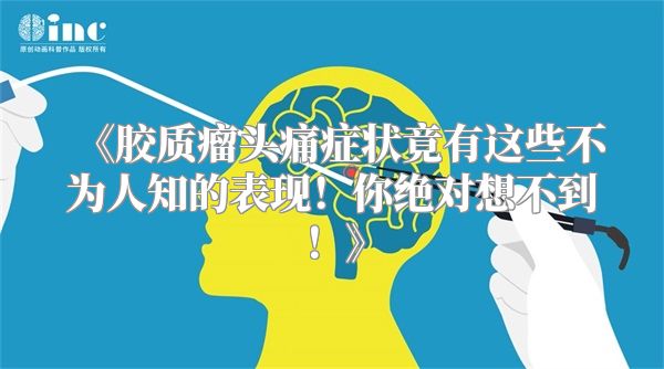 《胶质瘤头痛症状竟有这些不为人知的表现！你绝对想不到！》