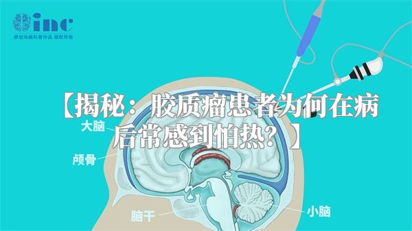 【揭秘：胶质瘤患者为何在病后常感到怕热？】