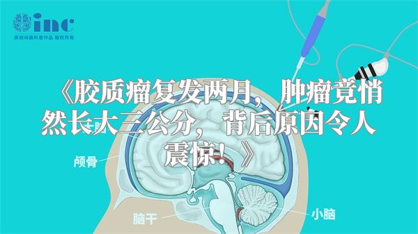 《胶质瘤复发两月，肿瘤竟悄然长大三公分，背后原因令人震惊！》