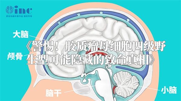 警惕！胶质瘤母细胞四级野生型可能隐藏的致命真相