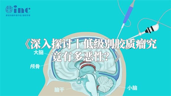 《深入探讨丨低级别胶质瘤究竟有多恶性？》