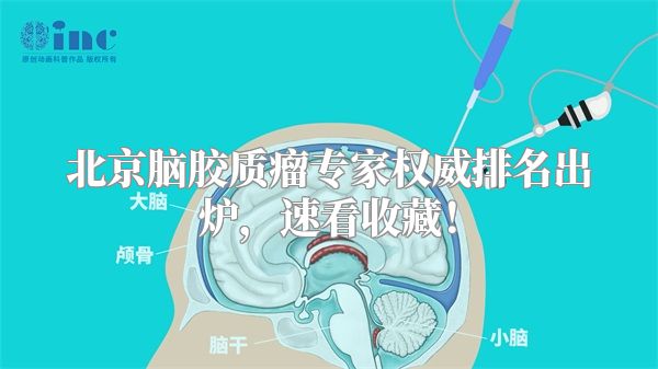 北京脑胶质瘤专家权威排名出炉，速看收藏！