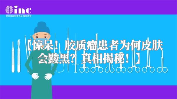 【惊呆！胶质瘤患者为何皮肤会黢黑？真相揭秘！】