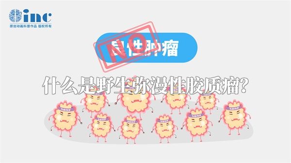 什么是野生弥漫性胶质瘤？