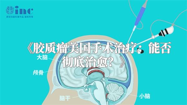 胶质瘤美国手术治疗：能否彻底治愈？