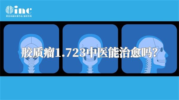 胶质瘤1.723中医能治愈吗？