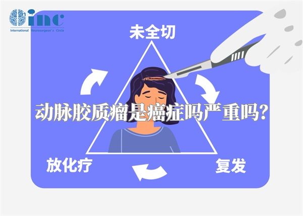 动脉胶质瘤是癌症吗严重吗？