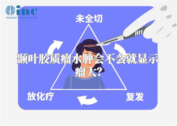 颞叶胶质瘤水肿会不会就显示瘤大？