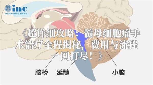 《超详细攻略：髓母细胞瘤手术治疗全程揭秘，费用与流程一网打尽！》