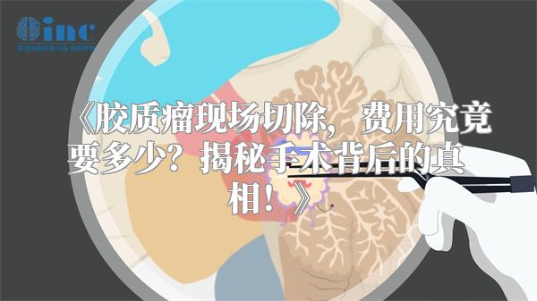 《胶质瘤现场切除，费用究竟要多少？揭秘手术背后的真相！》