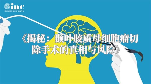 《揭秘：颞叶胶质母细胞瘤切除手术的真相与风险》