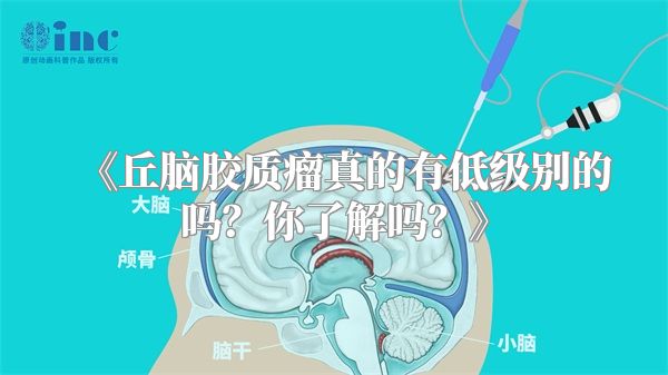 《丘脑胶质瘤真的有低级别的吗？你了解吗？》
