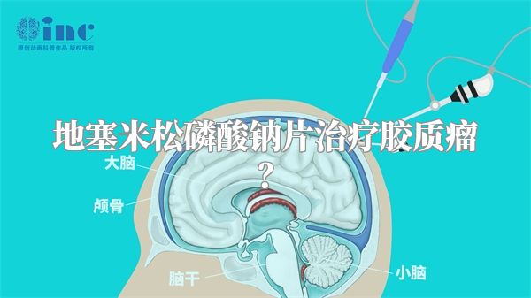 地塞米松磷酸钠片治疗胶质瘤？